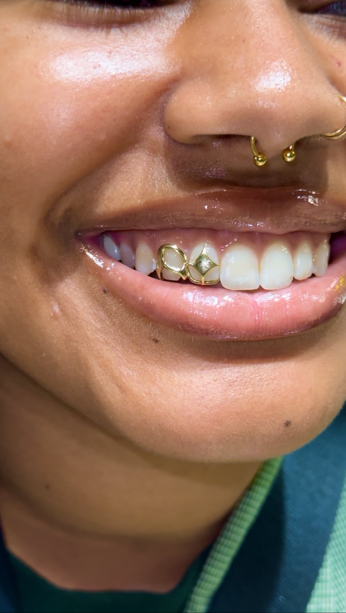 Load video: 10k Custom Interstellar Grillz